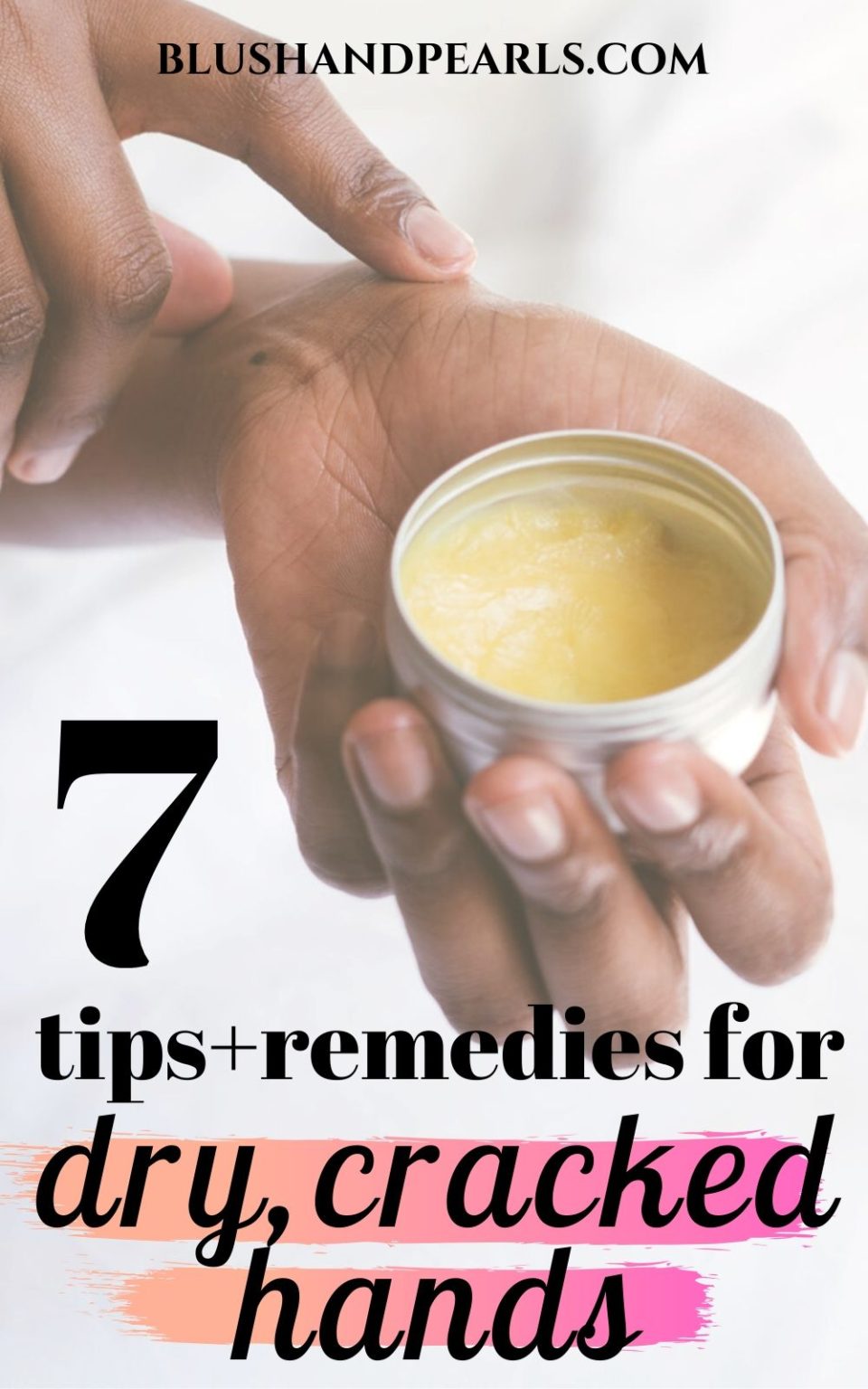 The Best Remedies And Tips For Dry Cracked Hands Blush And Pearls